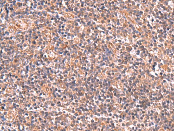 Immunohistochemistry of paraffin-embedded Human tonsil tissue  using UBAC1 Polyclonal Antibody at dilution of 1:50(?200)