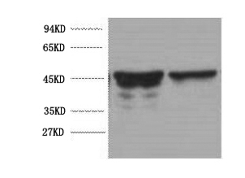 Western Blot analysis of Rat brain using GFAP Monoclonal Antibody at dilution of 1:5000.