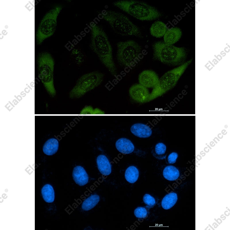 Recombinant Profilin 1 Monoclonal Antibody - 2