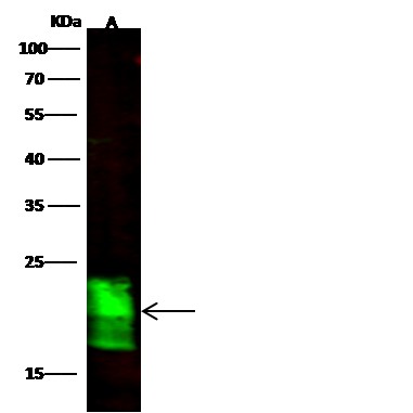 Recombinant ASF1B Monoclonal Antibody - small - 2