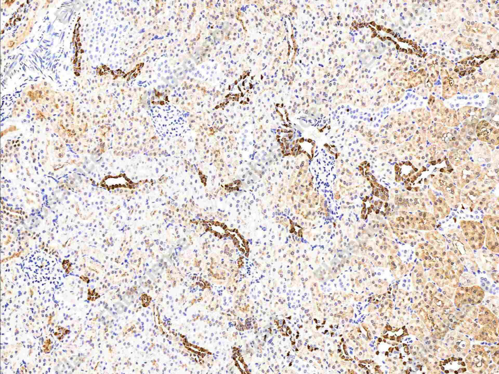 Recombinant Carbonic Anhydrase II/CA2 Monoclonal Antibody - 3