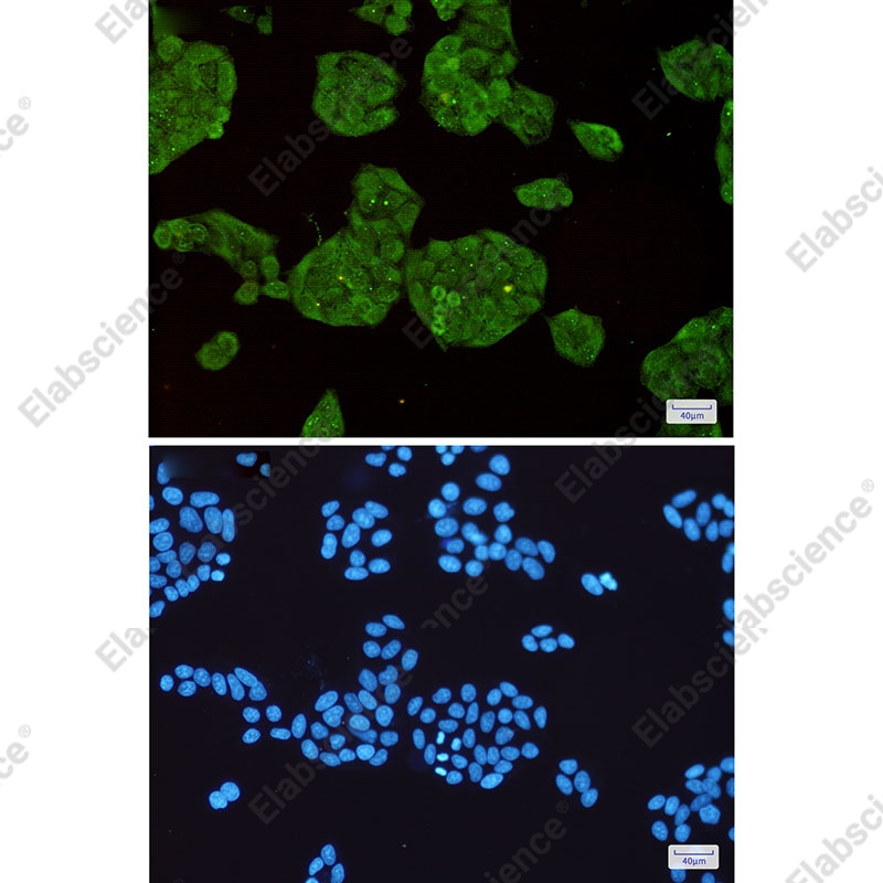 Recombinant STUB1 Monoclonal Antibody - 2