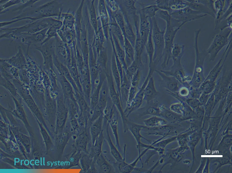 Human Pulmonary Artery Smooth Muscle (Primary cell immortalization) Cell Complete MediumHuman Pulmonary Artery Smooth Muscle (Primary cell immortalization) Cell Complete Medium - 4