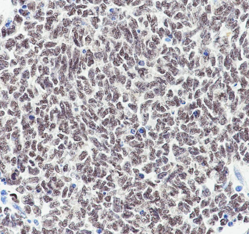 Recombinant WT1 Monoclonal Antibody - small - 5