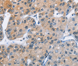 ATXN1 Polyclonal Antibody - 3