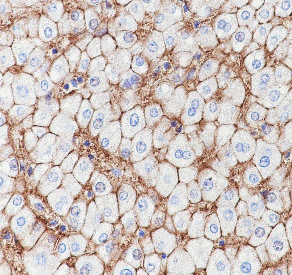 Recombinant ENPP1/PC1 Monoclonal Antibody - small - 3