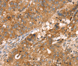 PDLIM4 Polyclonal Antibody - 2