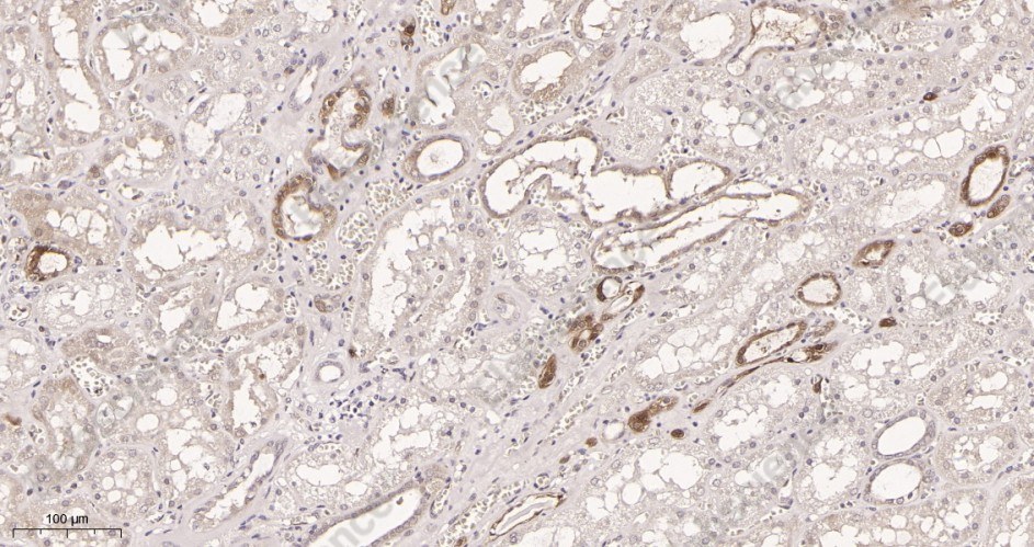 Recombinant NQO1 Monoclonal Antibody - 2
