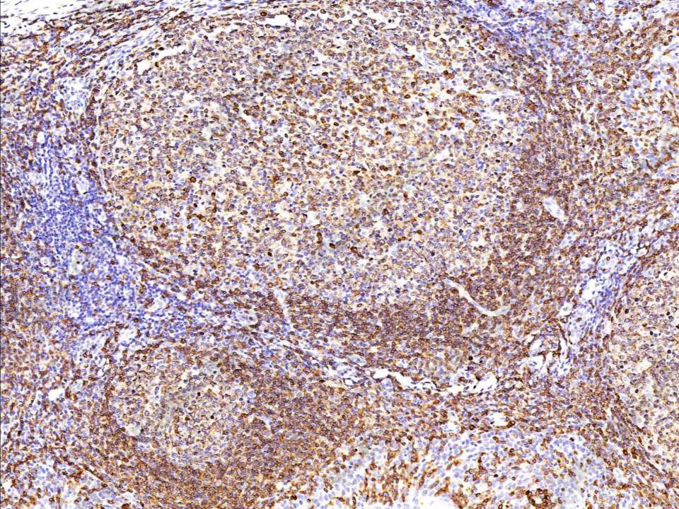 Recombinant CD79A/Ig-alpha Monoclonal Antibody - 1