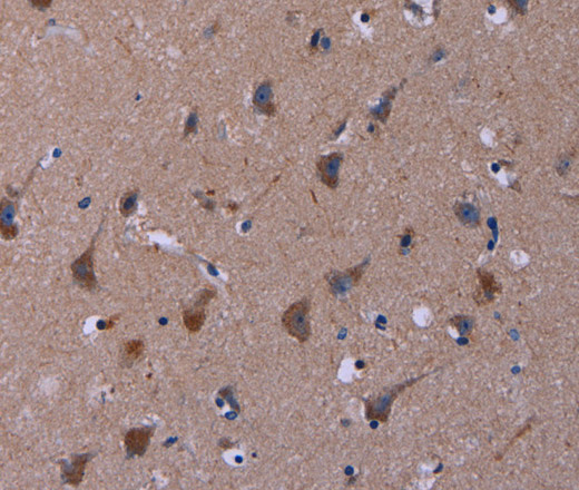 Immunohistochemistry of paraffin-embedded Human brain tissue using TUBGCP2 Polyclonal Antibody at dilution 1:50