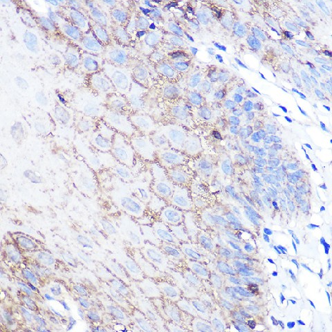 Immunohistochemistry of paraffin-embedded human esophageal using DJ-1/PARK7 Polyclonal Antibody at dilution of 1:100 (40x lens).Perform microwave antigen retrieval with 10 mM PBS buffer pH 7.2 before commencing with IHC staining protocol.