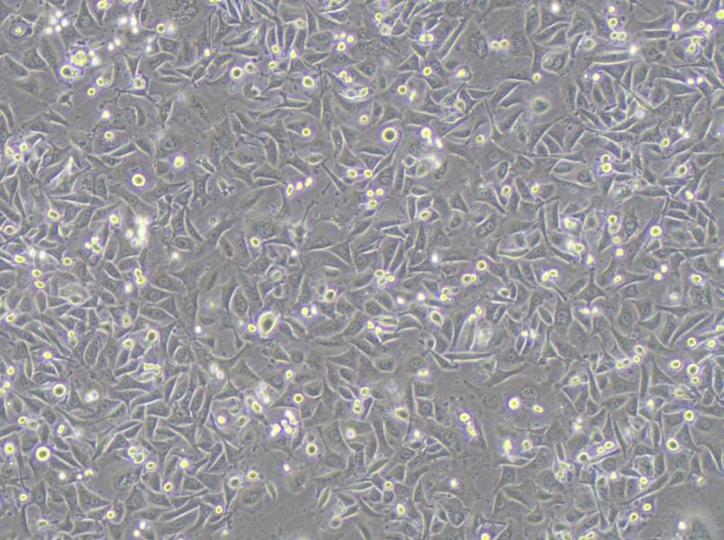 MKN1 Cell Complete Medium - 2