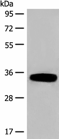 Western blot analysis of Human fetal liver tissue lysate  using DHRS1 Polyclonal Antibody at dilution of 1:400