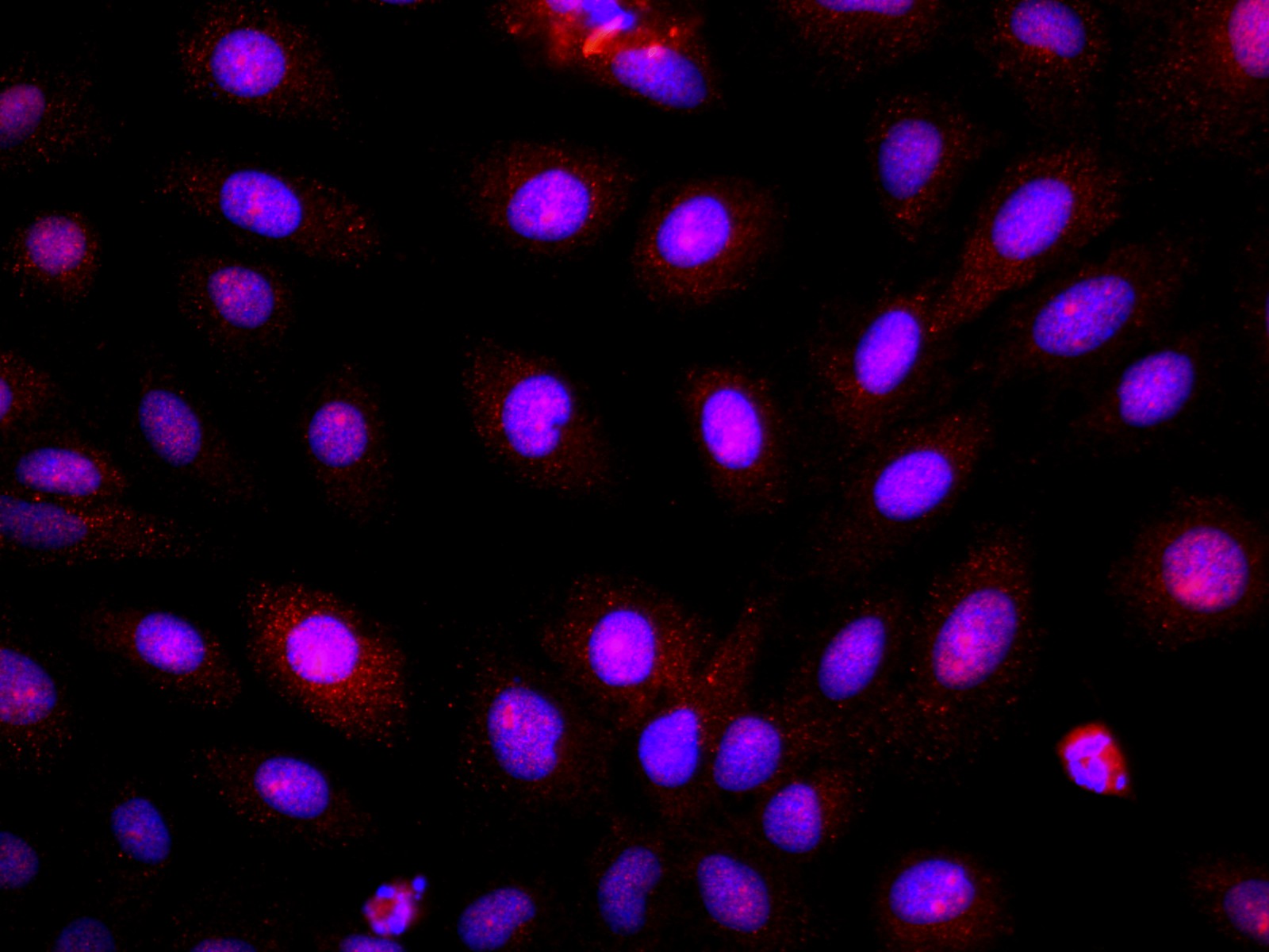 Immunofluorescence analysis of U-2OS cells using BRCA1 Polyclonal Antibody at dilution of 1:100