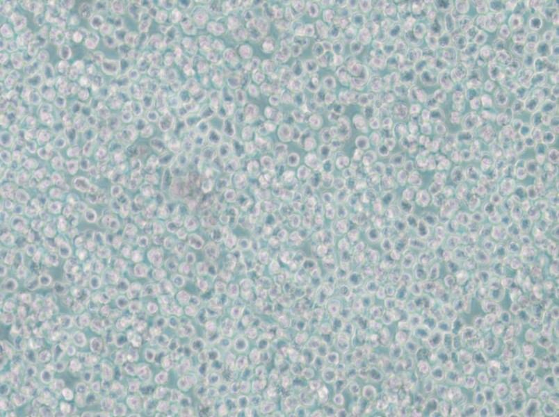 SKNO-1 Cell Complete Medium - 6