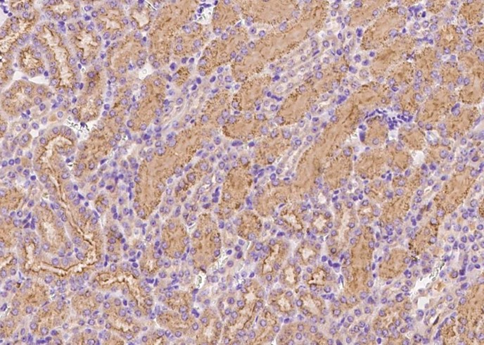 Recombinant Transferrin Receptor/TFRC Monoclonal Antibody - small - 2