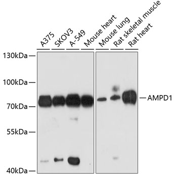 Western blot analysis of extracts of various cell lines using AMPD1 Polyclonal Antibody at dilution of 1:3000.