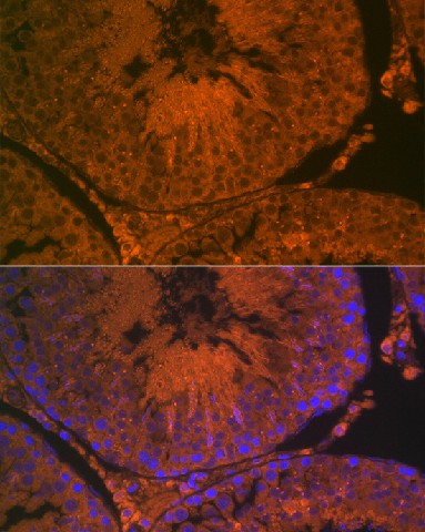 Immunofluorescence analysis of rat testis using ACE2 Polyclonal Antibody at dilution of 1:100 (40x lens). Blue: DAPI for nuclear staining.