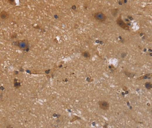 FRK Polyclonal Antibody - 3