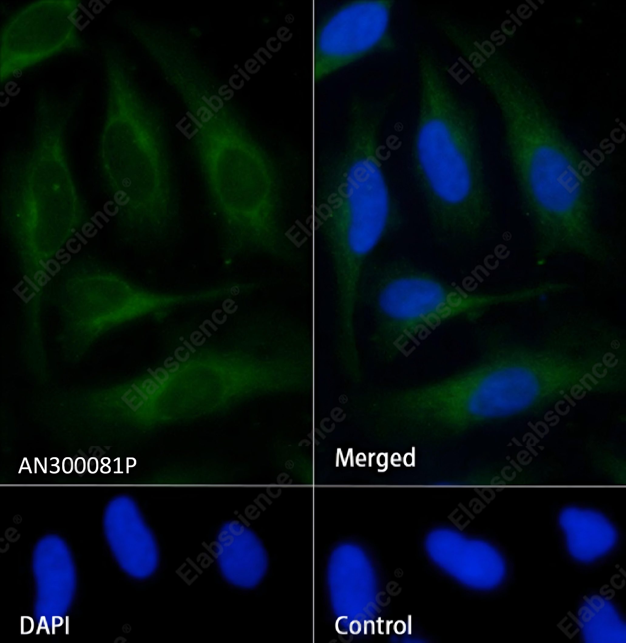 Recombinant S100A9 Monoclonal Antibody - 4