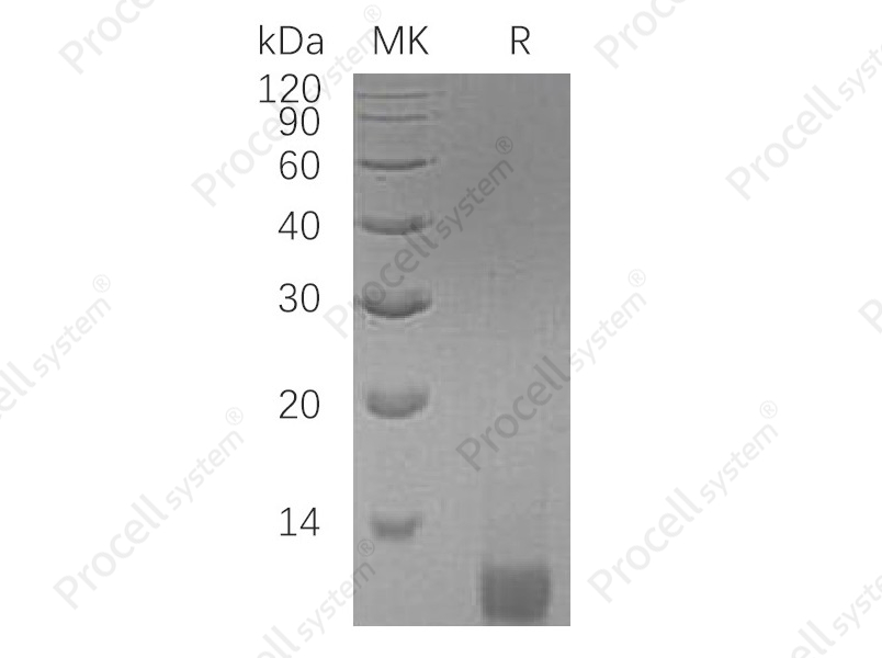 IGF-II/IGF2, Human, Recombinant