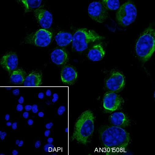 Recombinant Dynamin 1 Monoclonal Antibody - small - 5