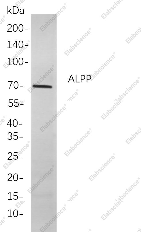 Recombinant ALPP Monoclonal Antibody - 1