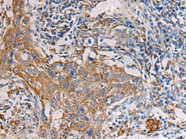 PAIP1 Polyclonal Antibody - small - 2
