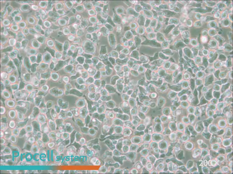 MM.1S Cell Complete Medium - small - 5