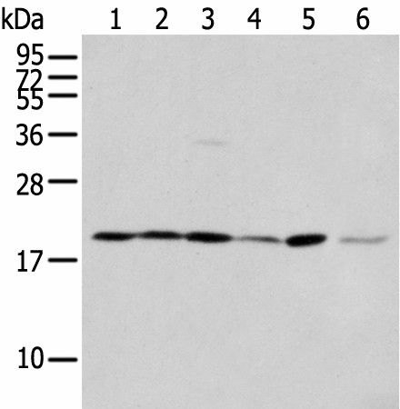 Western blot analysis of 293T cell Hepg2 cell and A431 cell  using EEF1E1 Polyclonal Antibody at dilution of 1:400