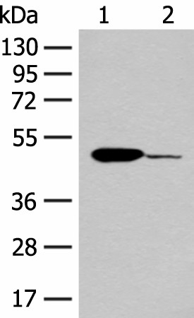 Western blot analysis of Mouse heart tissue and K562 cell lysates  using ACOD1 Polyclonal Antibody at dilution of 1:400