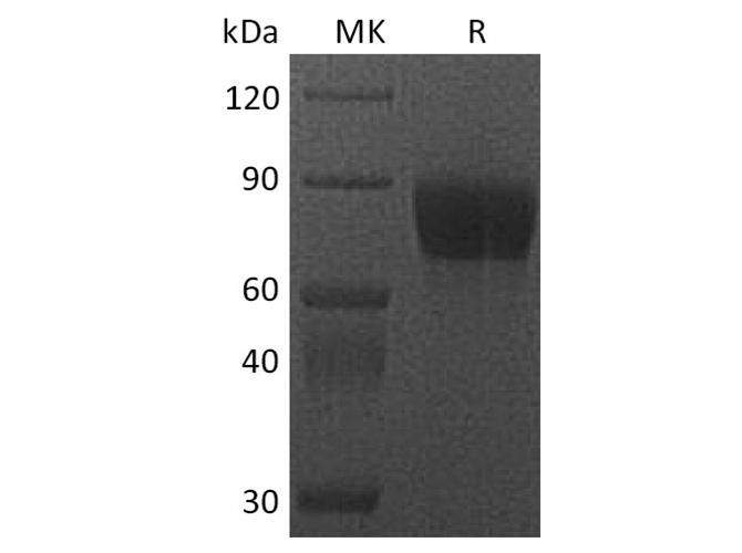 Recombinant Cynomolgus CSF1R/CD115 Protein (Fc Tag)