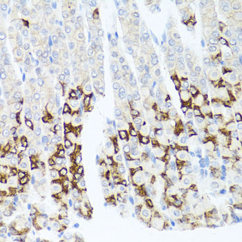 Immunohistochemistry of paraffin-embedded Mouse stomach using GPM6A Polyclonal Antibody at dilution of  1:100 (40x lens).