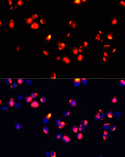 Immunofluorescence analysis of HeLa cells using FXN / FRataxin Polyclonal Antibody at dilution of 1:100 (40x lens). Blue: DAPI for nuclear staining.