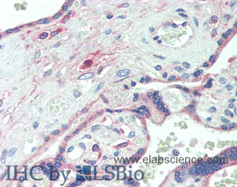 Immunohistochemistry of paraffin-embedded Placenta tissue using DLL4 Polyclonal Antibody at dilution of 1:60(Elabscience Product Detected by Lifespan).