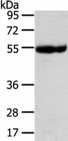 Western Blot analysis of Human placenta tissue using UBAP1 Polyclonal Antibody at dilution of 1/400