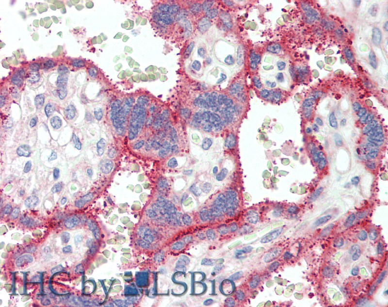 Immunohistochemistry of paraffin-embedded Placenta tissue using EPOR Polyclonal Antibody at dilution of 1:70(Elabscience Product Detected by Lifespan).