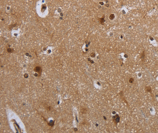 Immunohistochemistry of paraffin-embedded Human brain tissue using MTBP Polyclonal Antibody at dilution 1:40