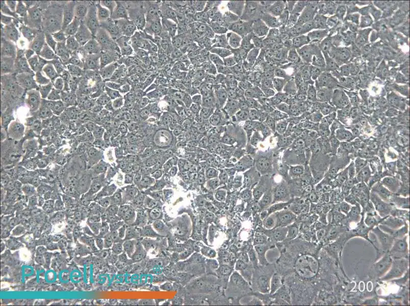 KYSE-140 Cell Complete Medium - 5