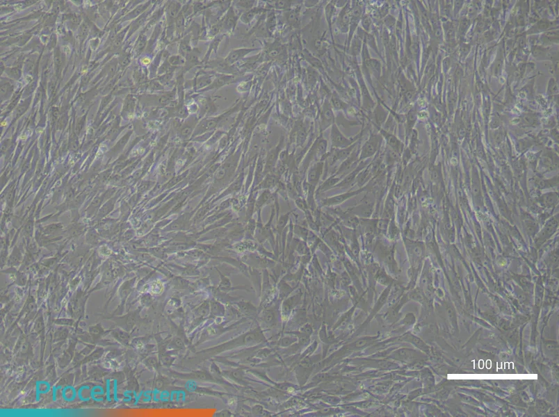 Human Preadipocyte Complete Medium - 3