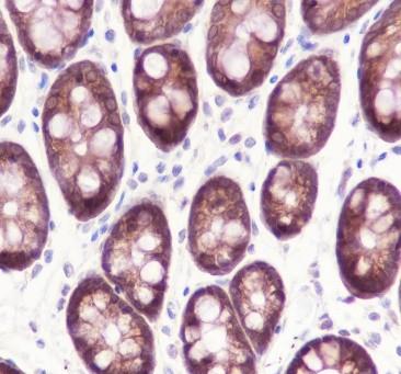 Recombinant Caspase-7 Monoclonal Antibody - 3