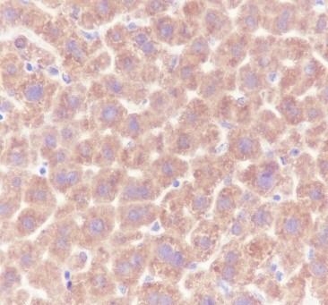 Recombinant ALDH7A1 Monoclonal Antibody - small - 4