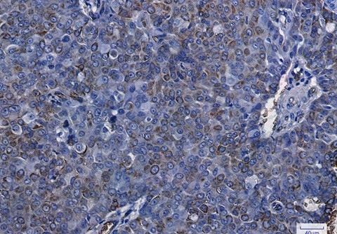Recombinant Aquaporin 1 Monoclonal Antibody - 2