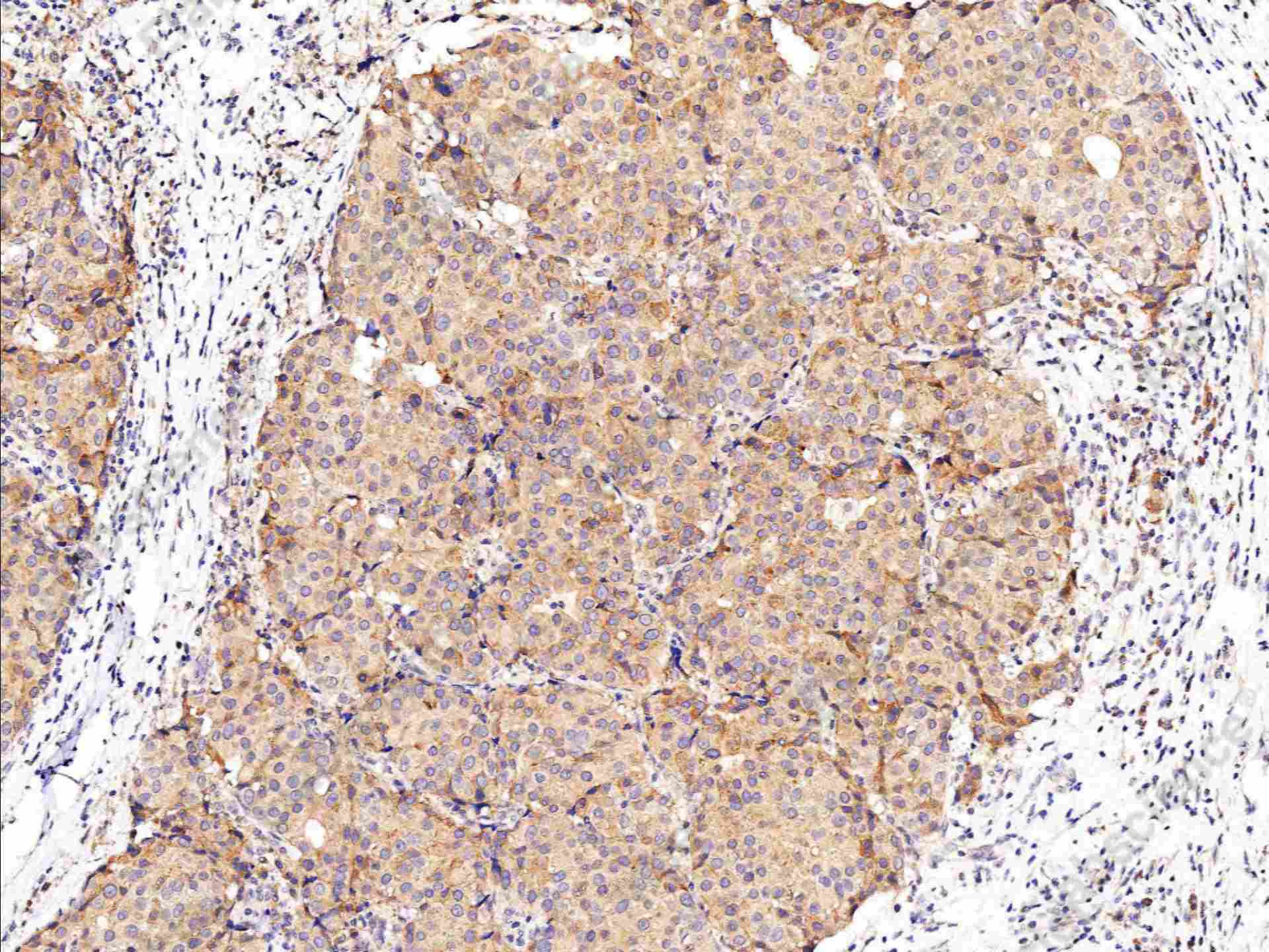 Recombinant ENTPD5 Monoclonal Antibody - 1