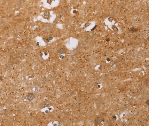 CD38 Polyclonal Antibody - 3
