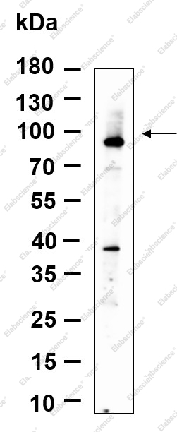 Recombinant ZNF160 Monoclonal Antibody - 1
