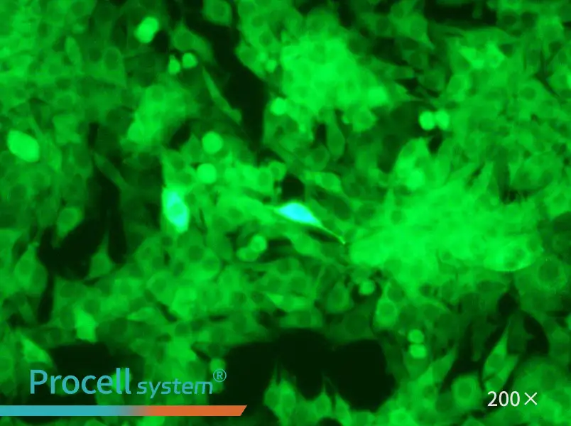 Panc02-GFP - 4