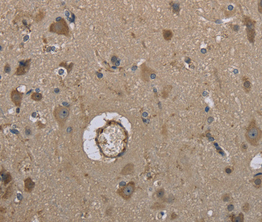 Immunohistochemistry of paraffin-embedded Human brain tissue using MARK4 Polyclonal Antibody at dilution 1:40