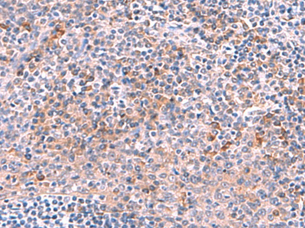 Immunohistochemistry of paraffin-embedded Human tonsil tissue  using NCAN Polyclonal Antibody at dilution of 1:30(?200)