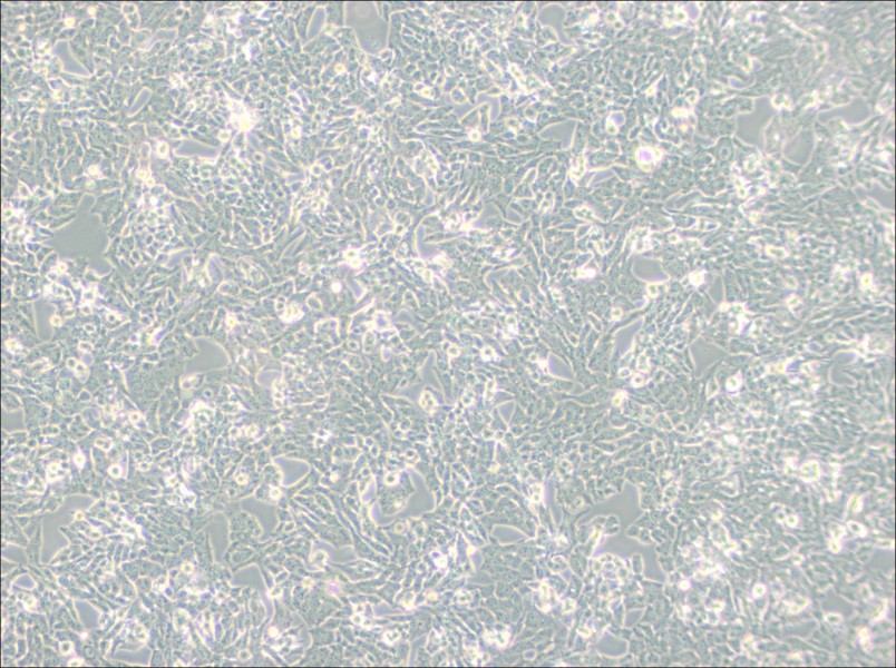 NCI-H295R Cell Complete MediumNCI-H295R Cell Complete Medium - 3